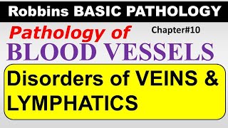 Ch10  Disorders of Veins amp Lymphatics  Blood Vessel Pathology  Robbins Lectures [upl. by Ander]