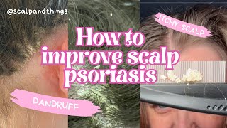 How to improve scalp psoriasis [upl. by Derdle844]