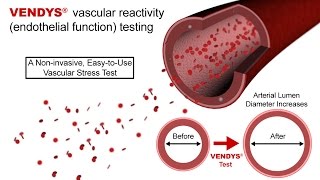 VENDYS  Endothelial Function Measurement Explained [upl. by Llatsyrk]