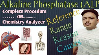 Alkaline Phosphatase ALP Urdu amp Hindi with procedure December 16 2020 [upl. by Adelia158]