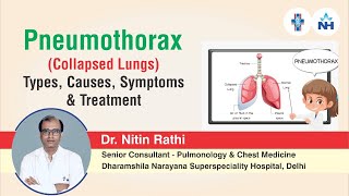 Pneumothorax  Types Causes Symptoms and Treatment  Dr Nitin Rathi [upl. by Ghassan684]