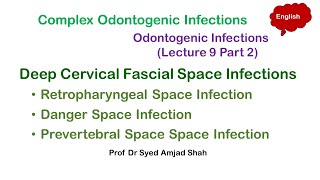 Retropharyngeal  Danger Prevertebral Space Infection  Deep Cervical Fascial Space Infections [upl. by Ericksen]