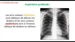 Comment interpréter une radiographie thoracique de face  Partie 1 [upl. by Lucias]