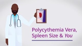 Polycythemia Vera Spleen Size amp You [upl. by Opiak]