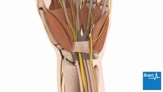 How open carpal tunnel surgery is carried out  Bupa Health [upl. by Ehtyde579]