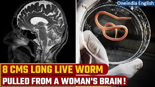 Australia 8cms long 1mm wide alive wriggling parasitic worm found in a womans brain [upl. by Nylassej]