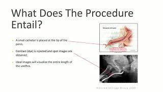 Retrograde Urethrogram amp voiding Cystourethrogram [upl. by Retseh]