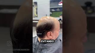 Como higienizar a prótese capilargardenformen6631 barber cabelo protesecapilarmasculina [upl. by Gill]