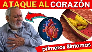 💔 SINTOMAS de INFARTO en Mujeres y Hombres ATAQUE AL CORAZÓN [upl. by Llet]