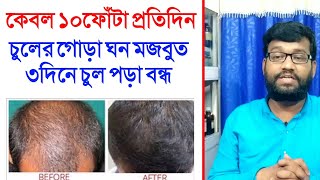 চুল পড়া বন্ধ ও নতুন চুল গজানোর ঘরোয়া উপায়  chul pora komanor upay  hair fall control [upl. by Stagg]