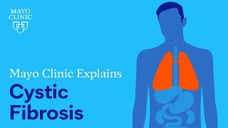 Mayo Clinic Explains Cystic Fibrosis [upl. by Orrocos]