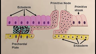 Fate of the Primitive Streak Teratomas formation of the Notochord Diastematomyelia Chordoma [upl. by Aserehs]