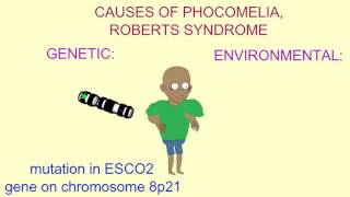 GENETIC amp ENVIRONMENTAL CAUSES OF PHOCOMELIA [upl. by Jacey189]