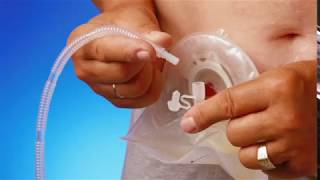 How to connect a urostomy pouch to night drainage bag [upl. by Hyde]