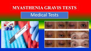 MYASTHENIA GRAVIS TESTS  Medical Lab Tests  What is   Uses  Need  Preparation  Results [upl. by Nauqas]