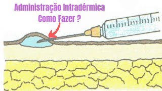 Administração intradérmica [upl. by Sierra]