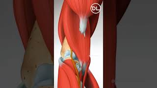 Weight Lift ചെയ്യുന്നവർ ശ്രദ്ധിക്കേണ്ടത്  Distal biceps tendon rupture [upl. by Ykciv]