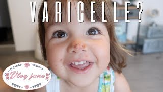 ELLE A LA VARICELLE  RETOUR A LA MAISON VLOG FAMILLE [upl. by Oninotna]