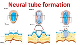 neural tube formation  Embryology  Neurulation [upl. by Eibrad]