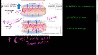 19  Acute Inflammation 1 of 3  Vascular permeability Vasodilation [upl. by Gwendolen]