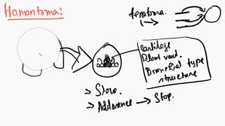 Hamartoma BN  Pathology  Pathology Short Video [upl. by Traci]