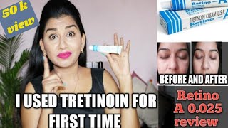 HOW I CLEARED MY SKIN IN 1 MONTH  Tretinoin Cream 0025 Before and After [upl. by Eedoj883]