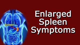 Enlarged Spleen Symptoms [upl. by Rurik685]