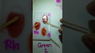 ABO Blood Typing Lab Demonstration [upl. by Ellenej]