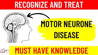 What is Motor Neuron Disease MND  All you need to know  Causes  Symptoms  Diagnosis Treatment [upl. by Tekcirk]