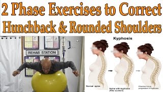 2 Phase Exercises to Correct Hunchback Kyphosis Rounded Shoulders  Dr Mandell [upl. by Smailliw660]