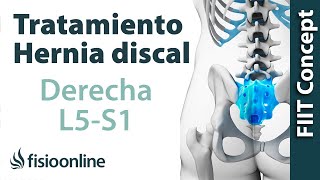 Tratamiento de la hernia discal L5 y S1 derecha o quinta lumbar y sacro [upl. by Messere952]