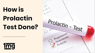 Prolactin  Endocrinology [upl. by Ennovyhs297]