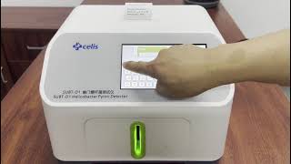 Celis helicobacter pylori urea breath test [upl. by Hsihsa]