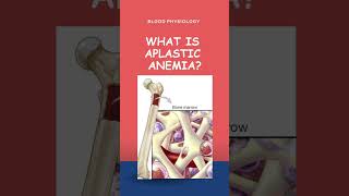 Aplastic anemia bloodphysiology [upl. by Chris]