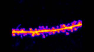 dendritic spines and filopodia [upl. by Anemix594]