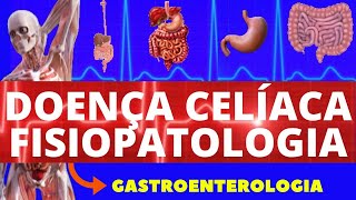 DOENÇA CELÍACA  FISIOPATOLOGIA COMO OCORRE A DOENÇA CELÍACA  GASTROENTEROLOGIA [upl. by Hamitaf898]