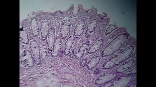 A histopathology د عبدالرحمن خليفه الجزء الاولwmv [upl. by Reiser789]