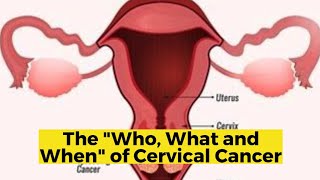 The Who What When of Cervical Cancer [upl. by Nyliuqcaj929]