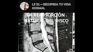 HERNIA DISCAL L5 S1  RECUPERA TU VIDA NORMAL LA REABSORCIÓN NATURAL DEL DISCO [upl. by Leunam]