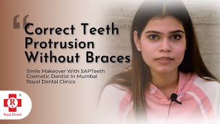 Correct Teeth Protrusion Without Braces  Cosmetic Dentist In Mumbai  SAPTeeth [upl. by Verge499]