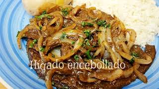 HÍGADO ENCEBOLLADO [upl. by Gipps]