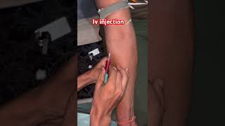 Iv injection viralvideo li [upl. by Holzman132]