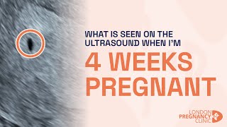 What does the 4 Week Pregnancy Scan look like A London Pregnancy Clinic case study [upl. by Revlys]