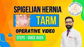 Spigelian Hernia TARM  Laparoscopic  Minimal Editing  Steps  Voice Over [upl. by Nomelc]