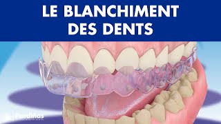 Blanchiment dentaire © [upl. by Rubina]