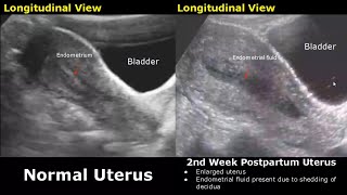 Gynecological amp Obstetric Ultrasound Normal Vs Abnormal Scan  Uterus Ovary Cervix Pregnancy USG [upl. by Heisel]