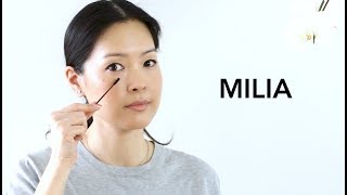 Milia  How to Treat amp Prevent  Best Eye Products [upl. by Bronk]