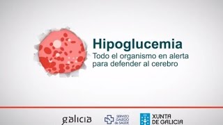 Signos y síntomas de la hipoglucemia [upl. by Eceinahs618]