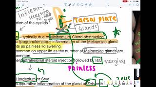 Diseases of eyelid Chalazion and Hordeolum for Medical Students Opthalmology 3 [upl. by Trey428]