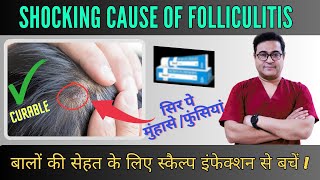 Shocking Causes Of Folliculitis You Never Knew  Cause Symptoms amp Treatment  follicullitis [upl. by Leicester839]